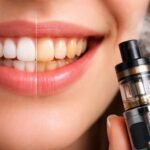 découvrez l'impact de la cigarette électronique sur le jaunissement des dents et les conseils pour maintenir un sourire éclatant malgré le vapotage.