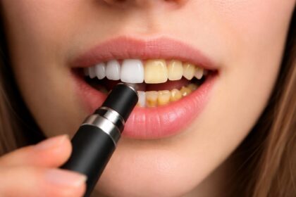 découvrez si la cigarette électronique est responsable du jaunissement des dents et comment préserver un sourire éclatant malgré le vapotage.